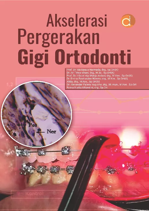 Akselerasi Pergerakan Gigi Ortodonti